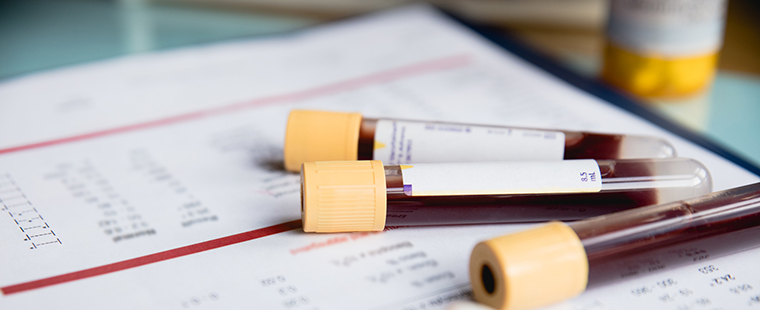 Blood test tubes sit on a sheet of results.