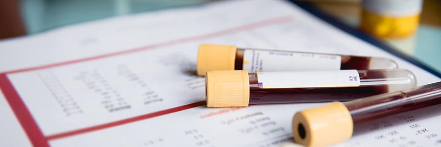 Tubes de prélèvement sanguin sur une feuille de résultats avec un stéthoscope en avant-plan.